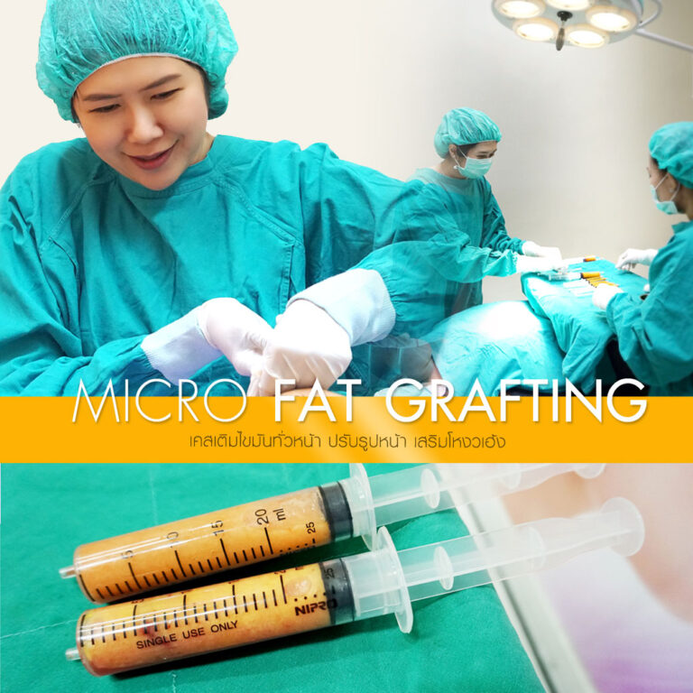 Micro Fat Grafting