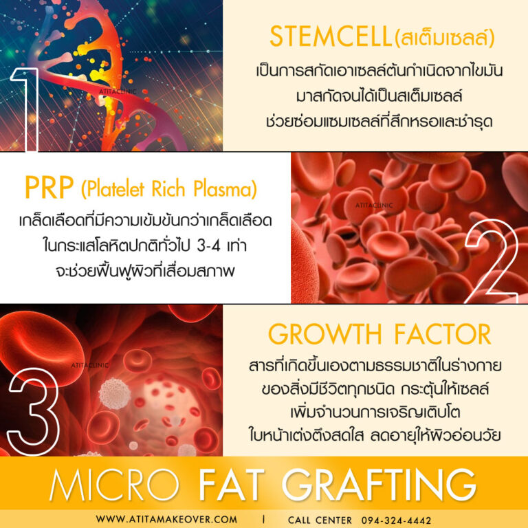 STEMCELL and PRP and Growth Factor