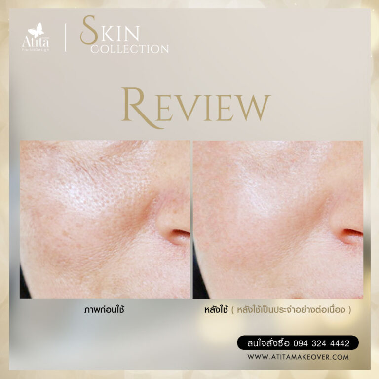 Review Skin Collection