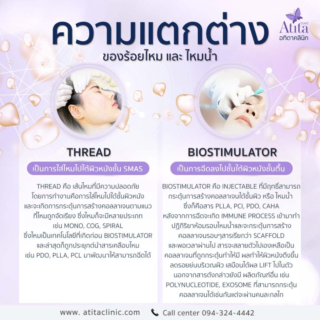 ความแตกต่างระหว่างร้อยไหมและไหมน้ำ
