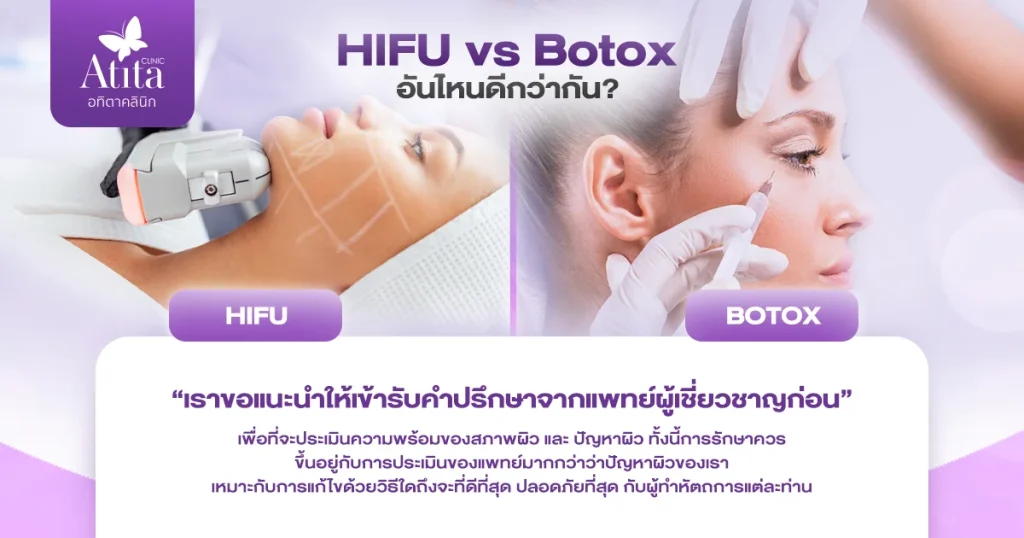 ข้อแตกต่างระหว่าง HIFU กับ Botox