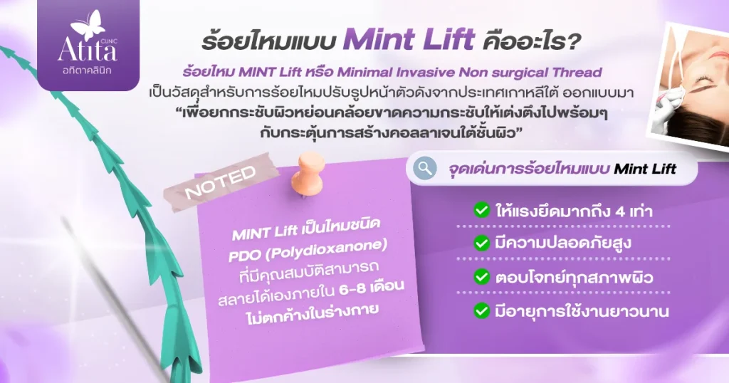 ร้อยไหมแบบ Mint Lift คืออะไร