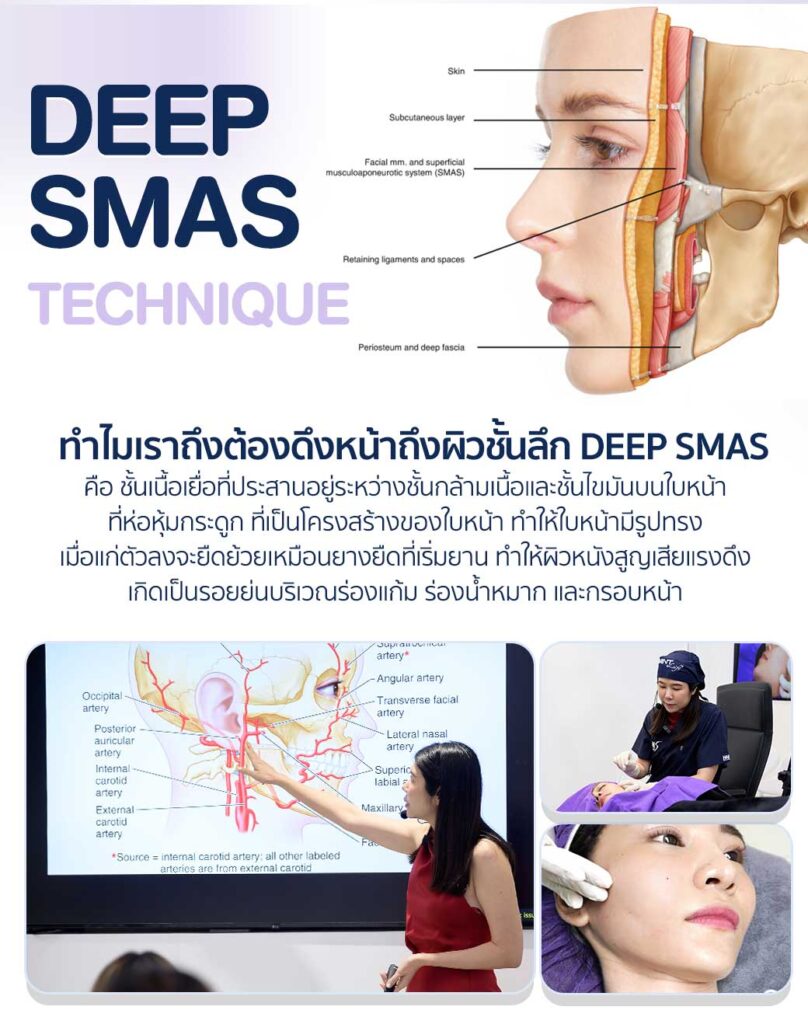 ร้อยไหม ไหมอิตาลี deepsmas
