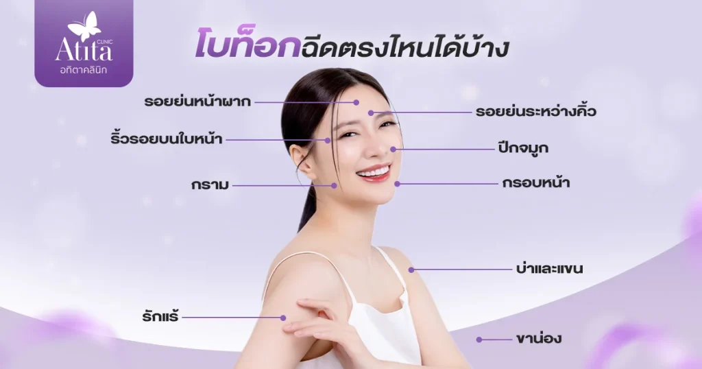 โบท็อกฉีดตรงไหนได้บ้าง