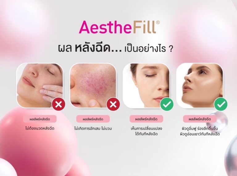 Aesthefil Aesthefilของแท้ Aesthefil ไทย Aesthefilคลินิก อทิตาคลินิก