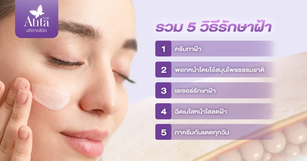 รวม 5 วิธีรักษาฝ้า