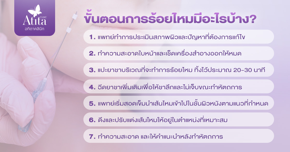 ขั้นตอนการร้อยไหมมีอะไรบ้าง?