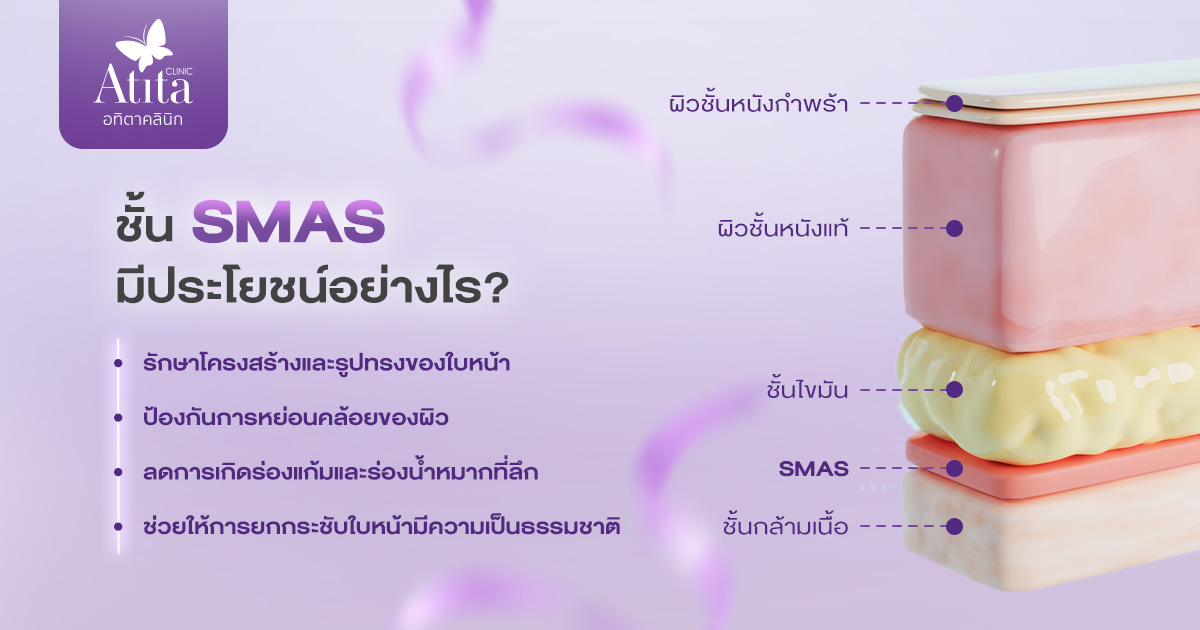 ชั้น SMAS มีประโยชน์อย่างไร?