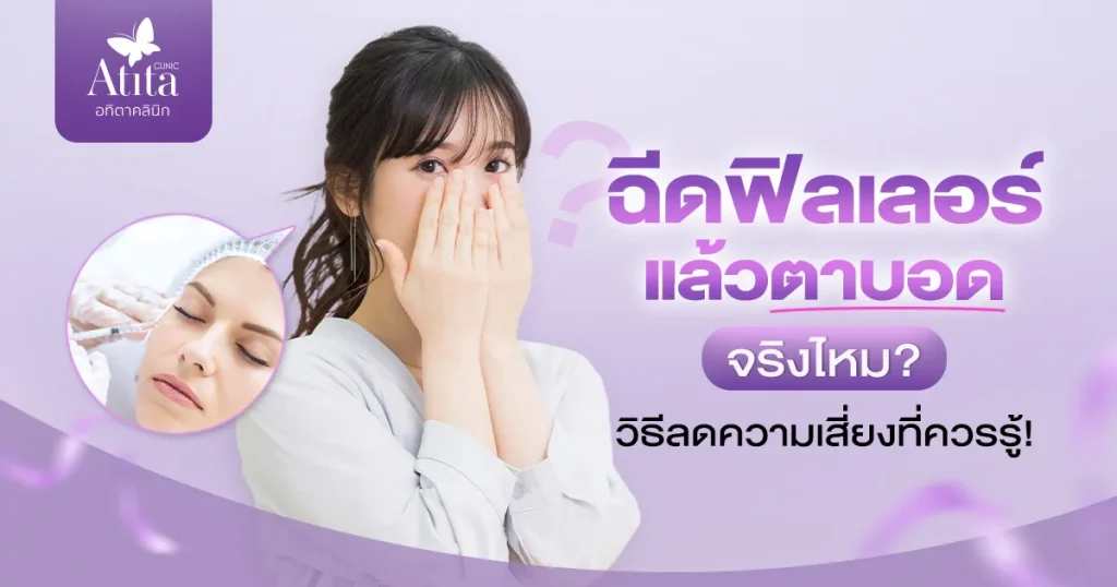 ฉีดฟิลเลอร์แล้วตาบอด จริงไหม