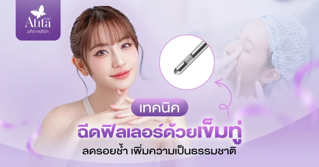 เทคนิคฉีดฟิลเลอร์ด้วยเข็มทู่