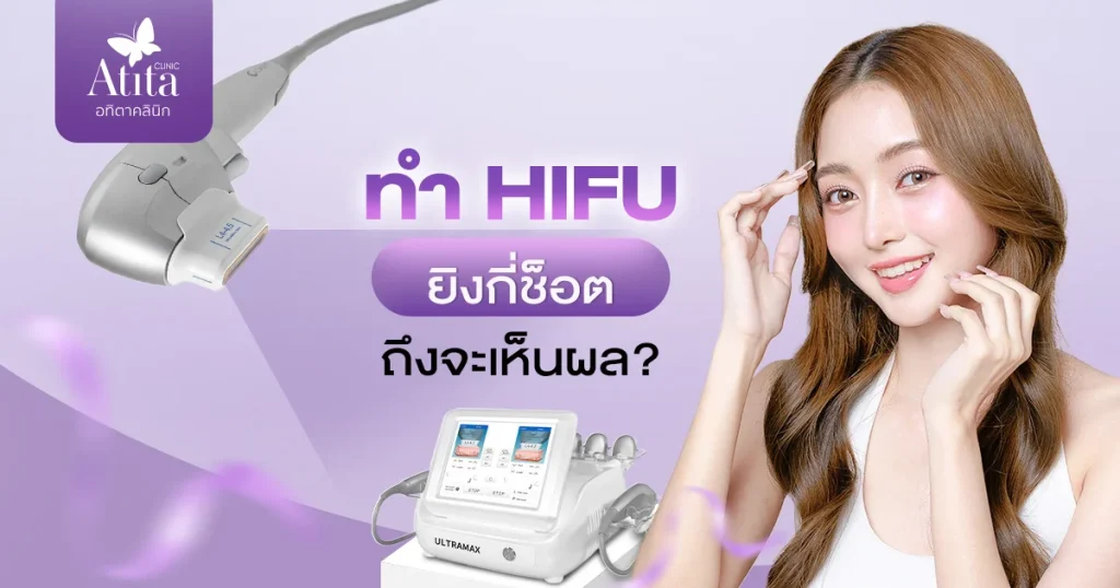 ทำ HIFU ยิงกี่ช็อตถึงจะเห็นผล?