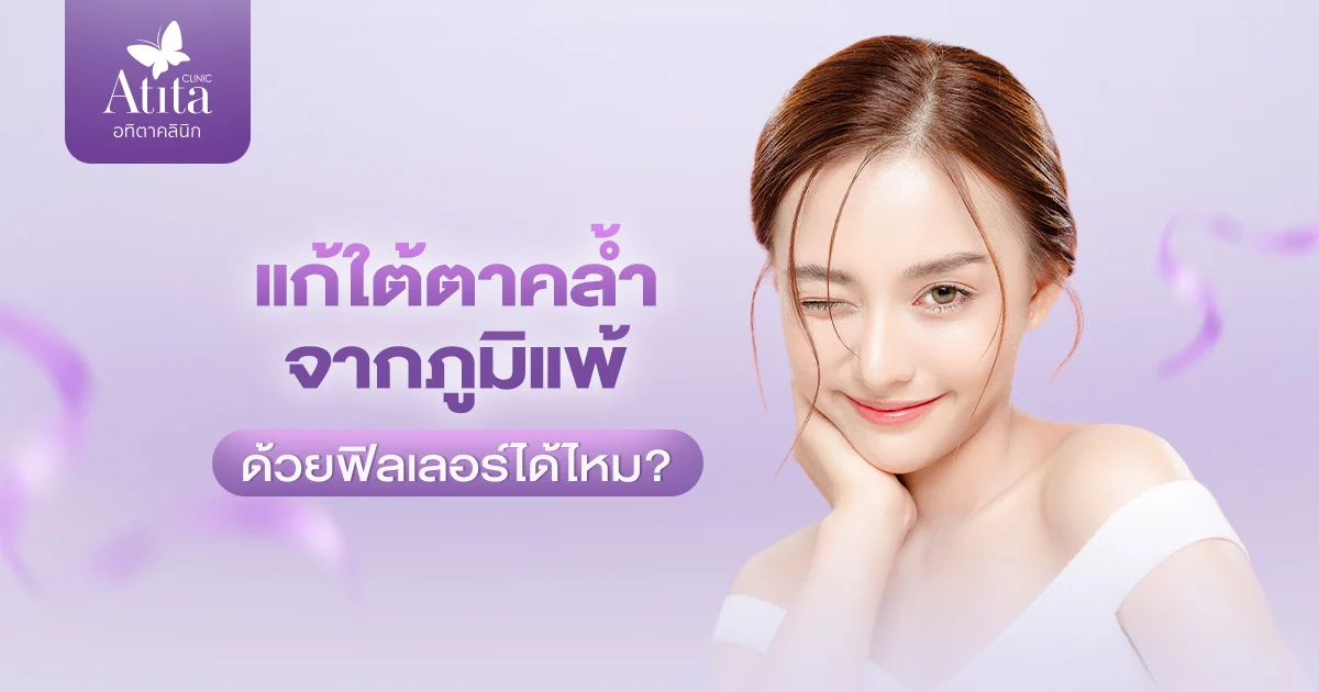 แก้ใต้ตาคล้ำจากภูมิแพ้ ด้วยฟิลเลอร์ได้ไหม?