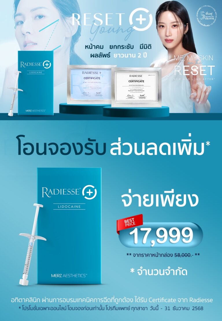 radiesse-เรเดียส-radiesseplus-เรเดียสพลัส-เรเดียสคืออะไร-โปรโมชั่น