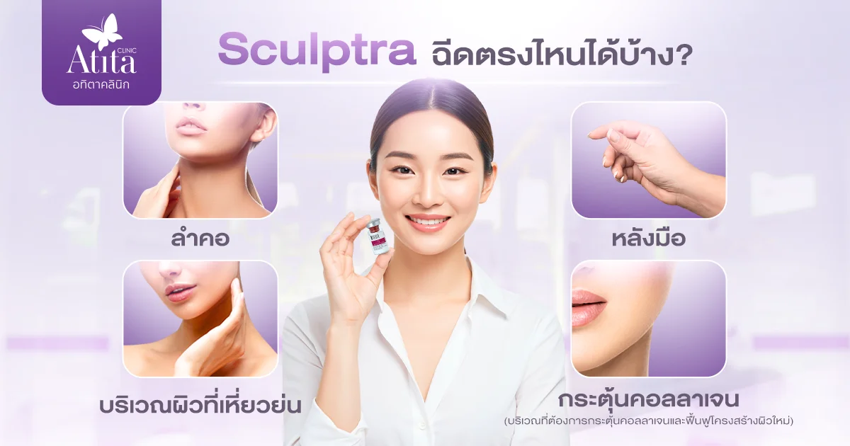 Sculptra ฉีดตรงไหนได้บ้าง