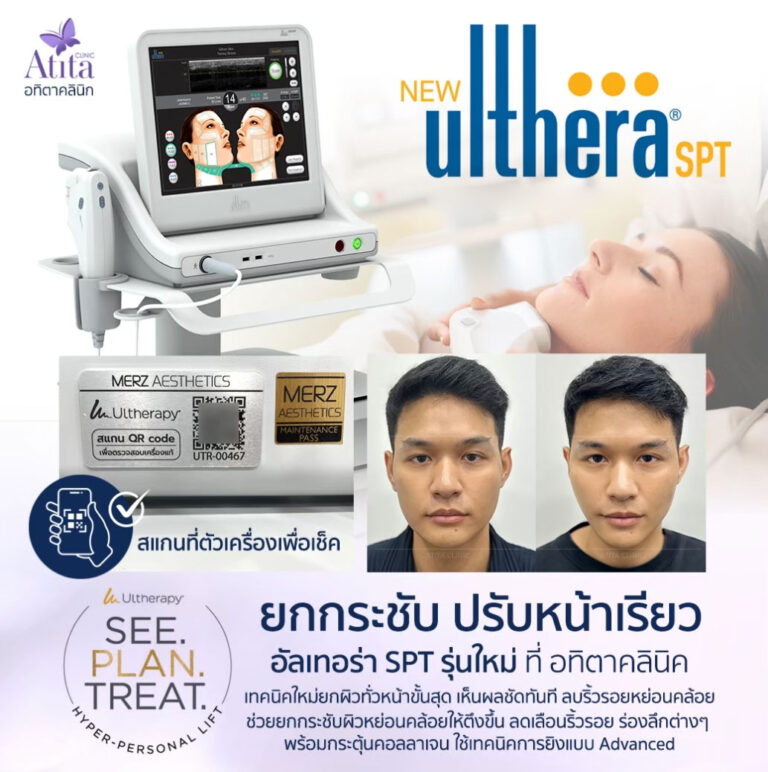 Ulthera-UltheraSPT