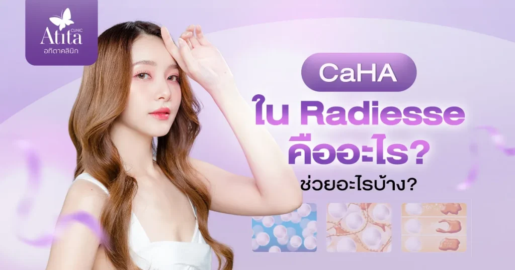 CaHA ใน Radiesse คืออะไร ช่วยอะไรบ้าง