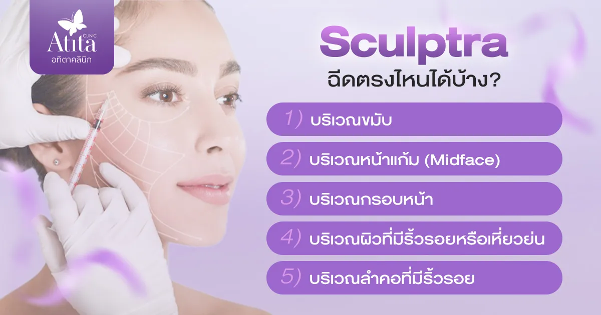 Sculptra ฉีดตรงไหนได้บ้าง