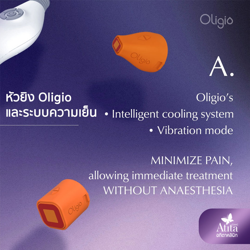 หัวยิง Oligio เครื่องOligio