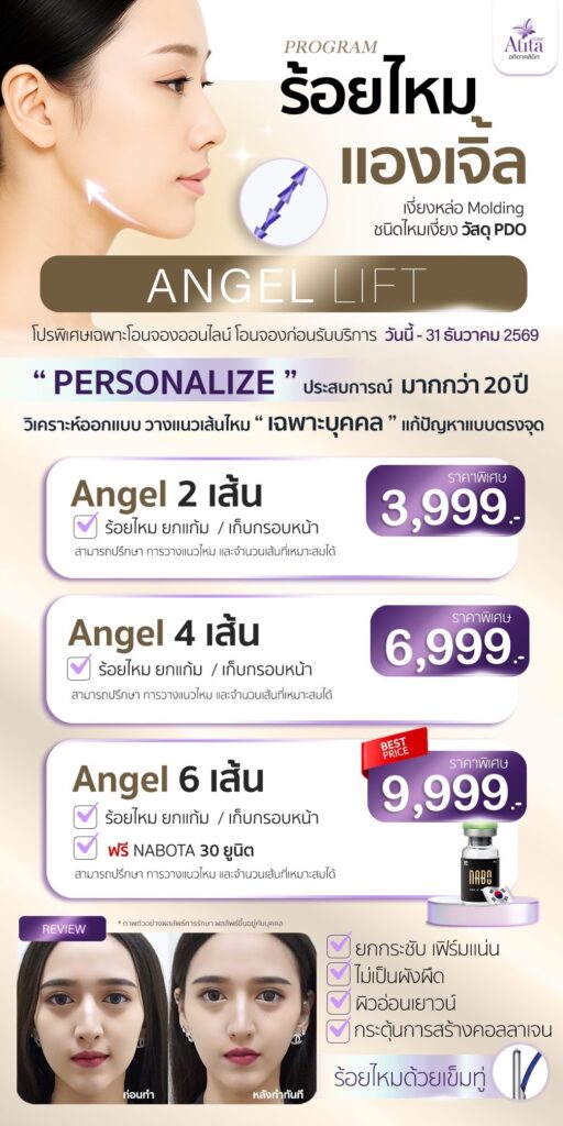 โปรร้อยไหม-ราคา-พิเศษลด-ปรับรูปหน้าเรียวสวย-จาก-Atita-Clinic-อทิตาคลินิก