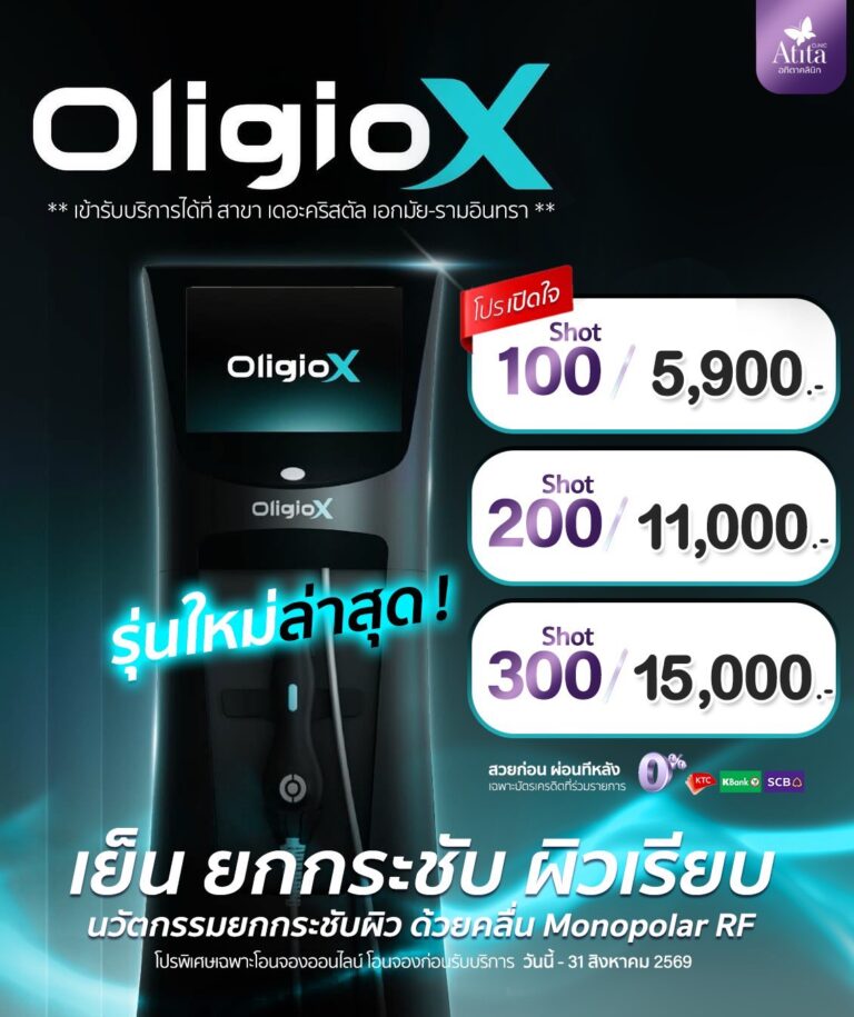 อัลเทอร่าไพร์ม Ulthera Prime ราคาถูก โปรโมชั่น อทิตาคลินิก