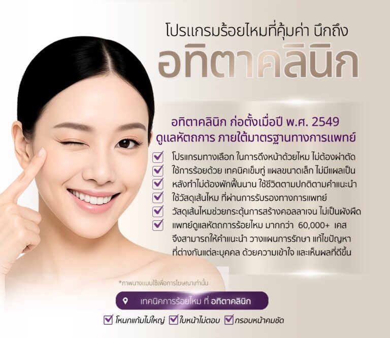 ร้อยไหม-ร้อยไหมดีไหม-ร้อยไหมที่ไหนดี-หมอเก่งร้อยไหม-ร้อยไหมอิตาลี