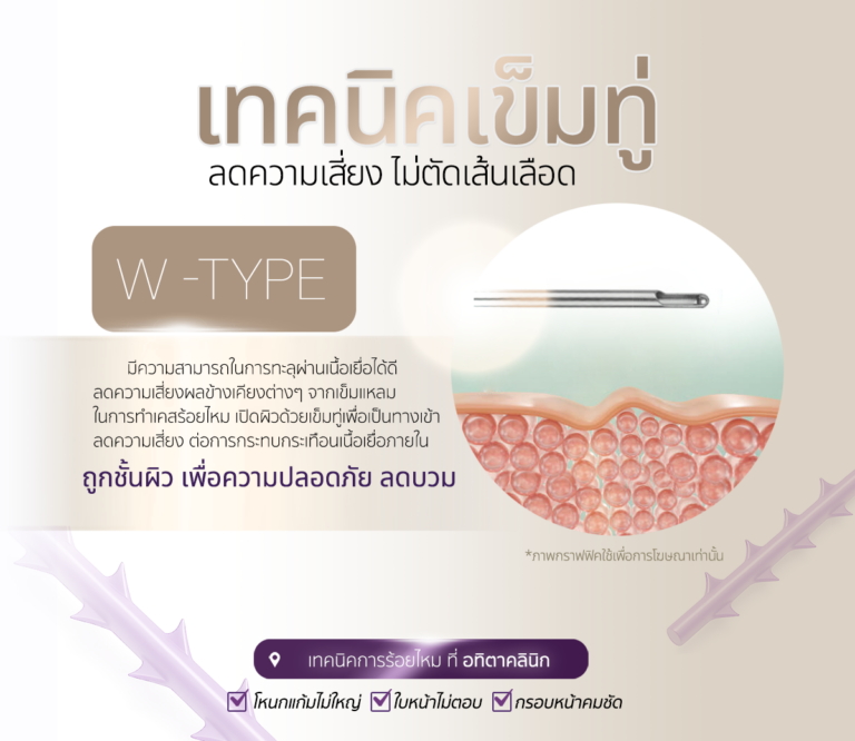ร้อยไหม-ร้อยไหมดีไหม-ร้อยไหมที่ไหนดี-หมอเก่งร้อยไหม-ร้อยไหมอิตาลี